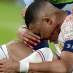 Kylian Mbappe Breaks Nose In France's Win Against Austria