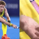 Australia Hockey Player Matt Dawson Amputates Part Of Finger To Participate In Paris Olympics 2024