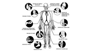 Pressure Points For Self Defense In Combat