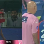 Watch: Kuldeep Yadav Suffers Scary Injury, IPL 2025 Campaign Under Threat