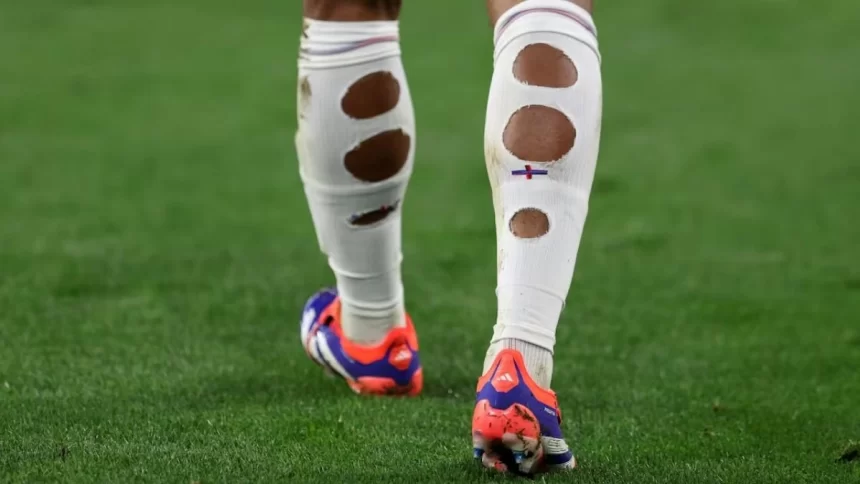 Why Footballers Wear Torn Socks: The Real Reason Behind The Trend