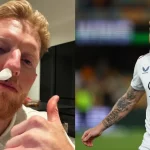 How Ben Stokes Suffered Serious Facial Injuries During Durham Net Session