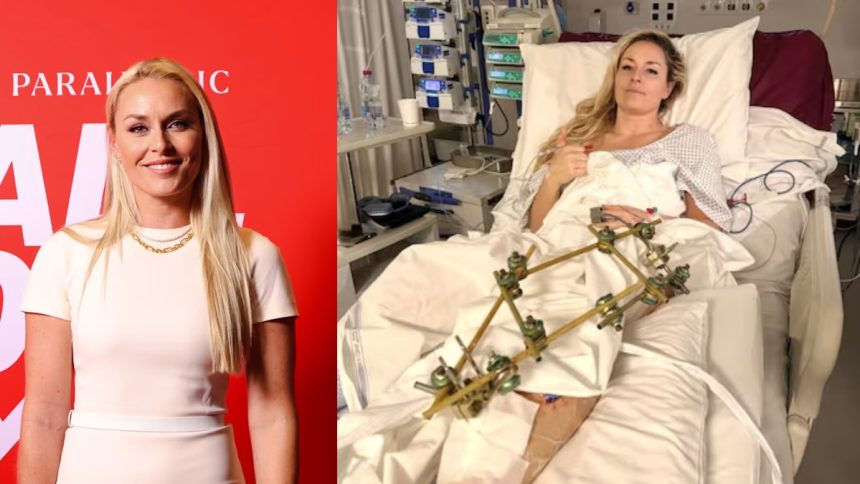 Lindsey Vonn Injury 2026